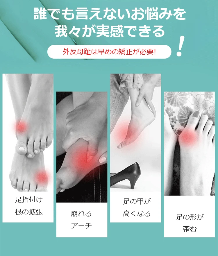 【日本骨科醫生推薦】Tenicore獨家3D旋調整骨拇指外翻矯正器， 科學矯正不傷骨 - 2