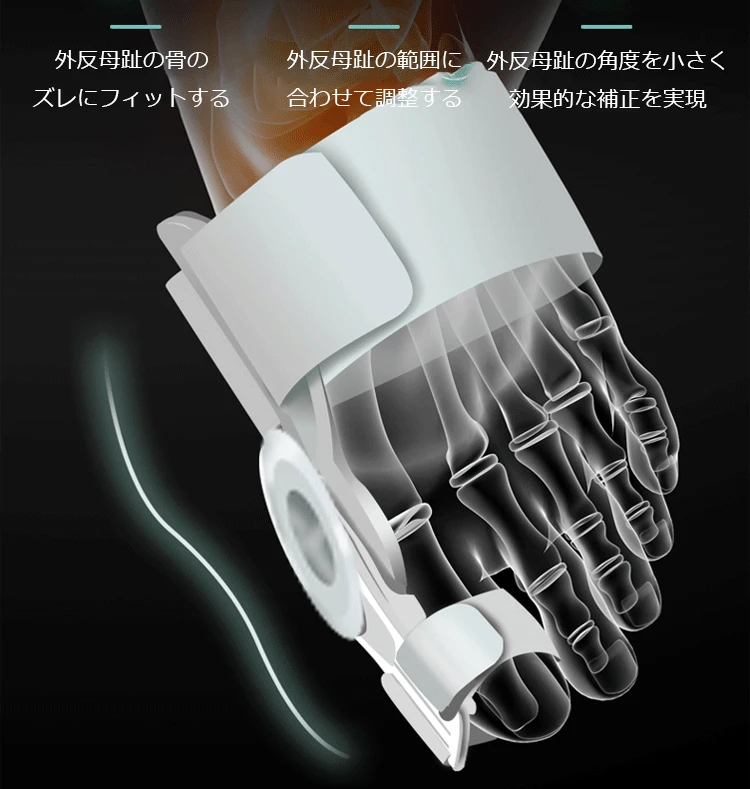 【日本骨科醫生推薦】Tenicore獨家3D旋調整骨拇指外翻矯正器， 科學矯正不傷骨 - 14